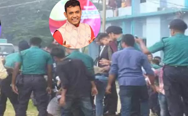কৌতুক অভিনেতা রনির শ্বাসনালী পুড়ে গেছে