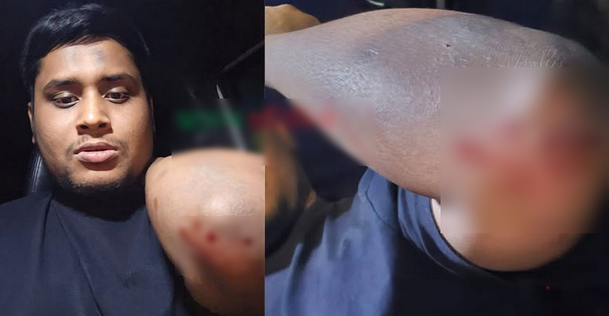গাজীপুরে হামলার শিকার এনসিপি নেতা হাসনাত আব্দুল্লাহ