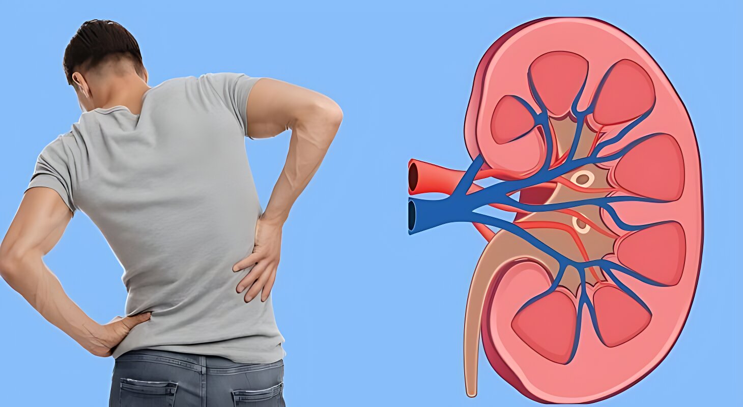 ৫ লক্ষণ দেখলেই বুঝবেন কিডনি ক্যানসার