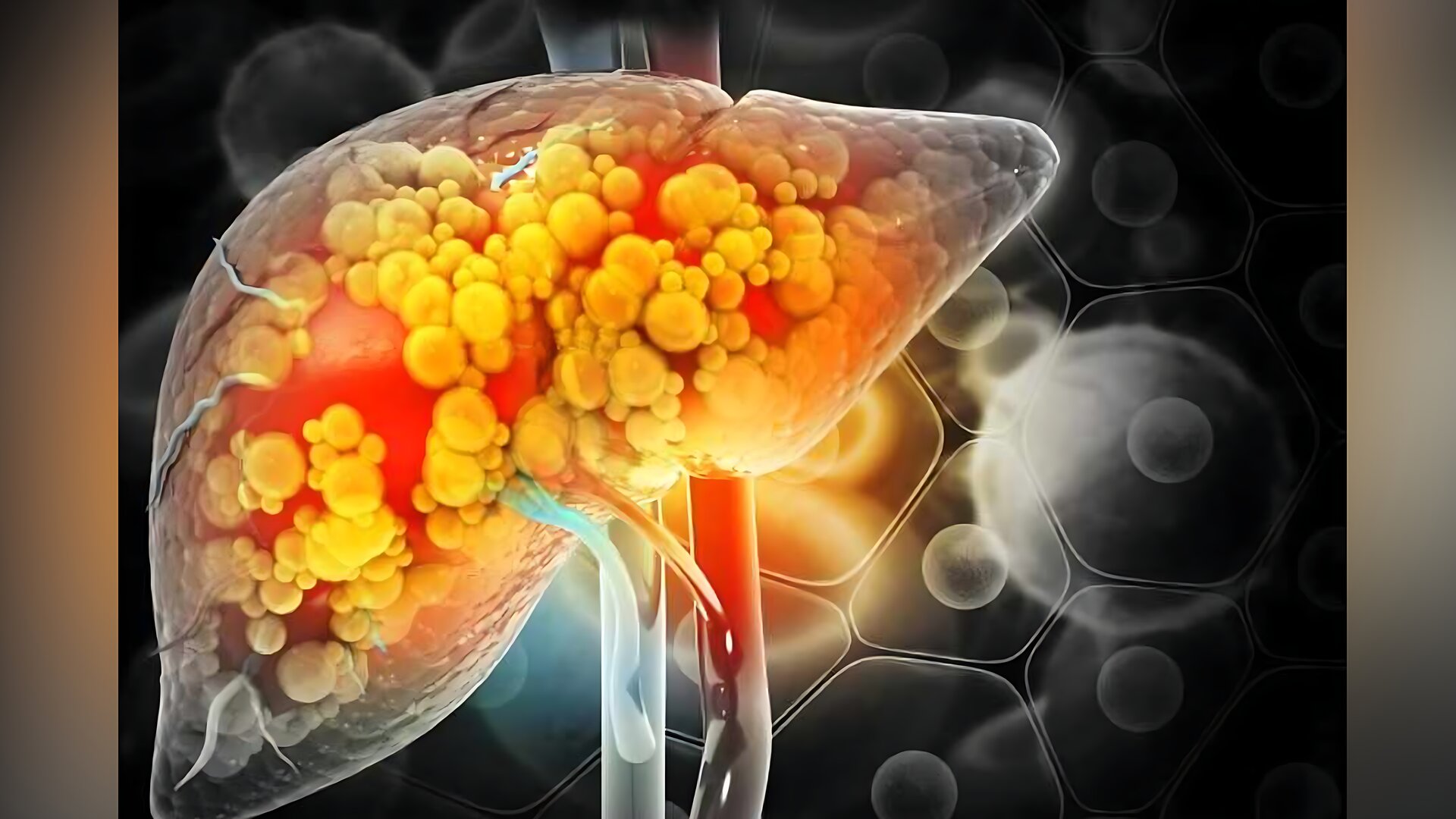 লিভারের সমস্যায় ত্বক দেয় ৪টি বিশেষ সংকেত