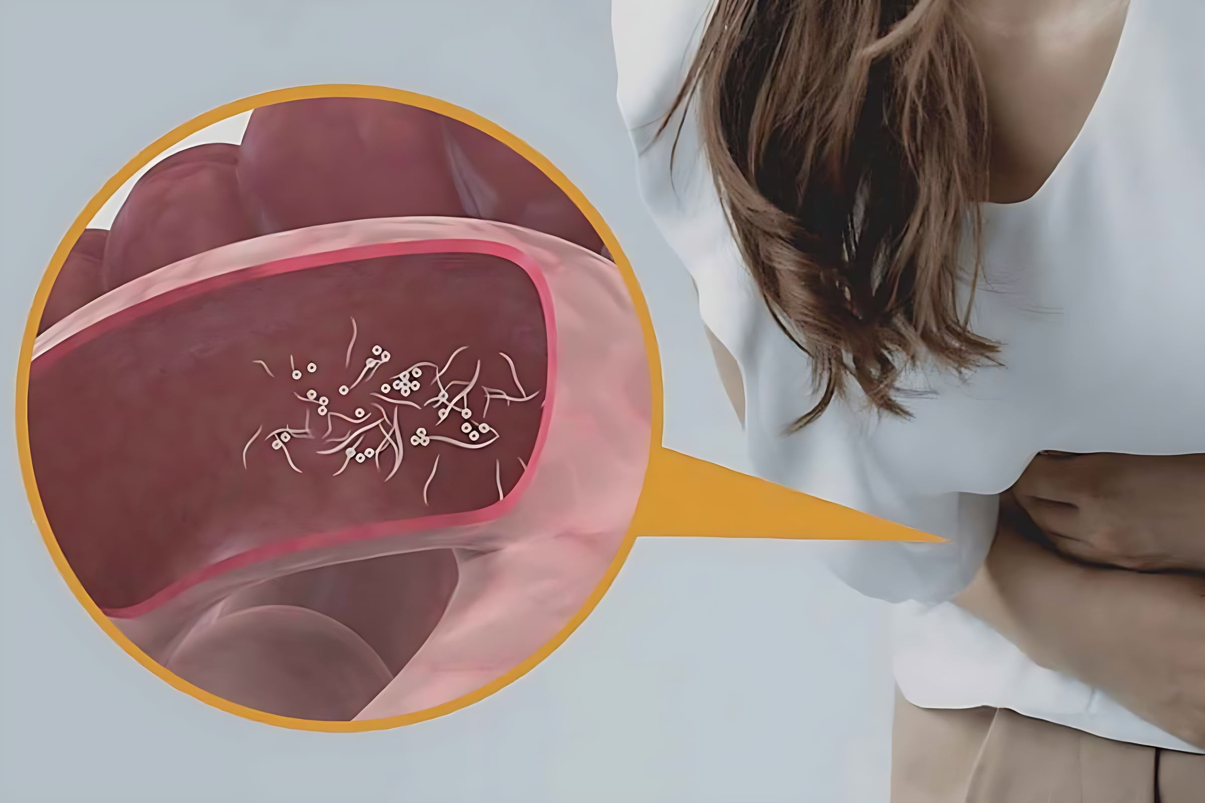 আপনার শরীরে কি কৃমি বাসা বেঁধেছে? চিনে নিন ৫টি প্রধান লক্ষণ