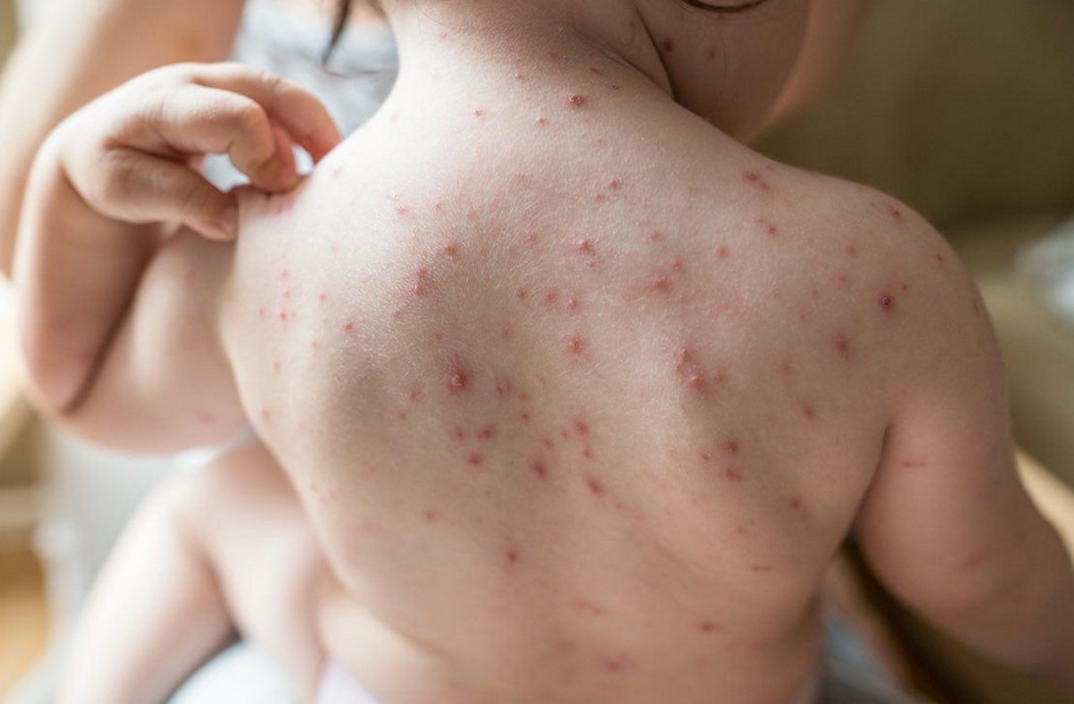 হামে সবচেয়ে বেশি ঝুঁকিতে রয়েছেন যারা