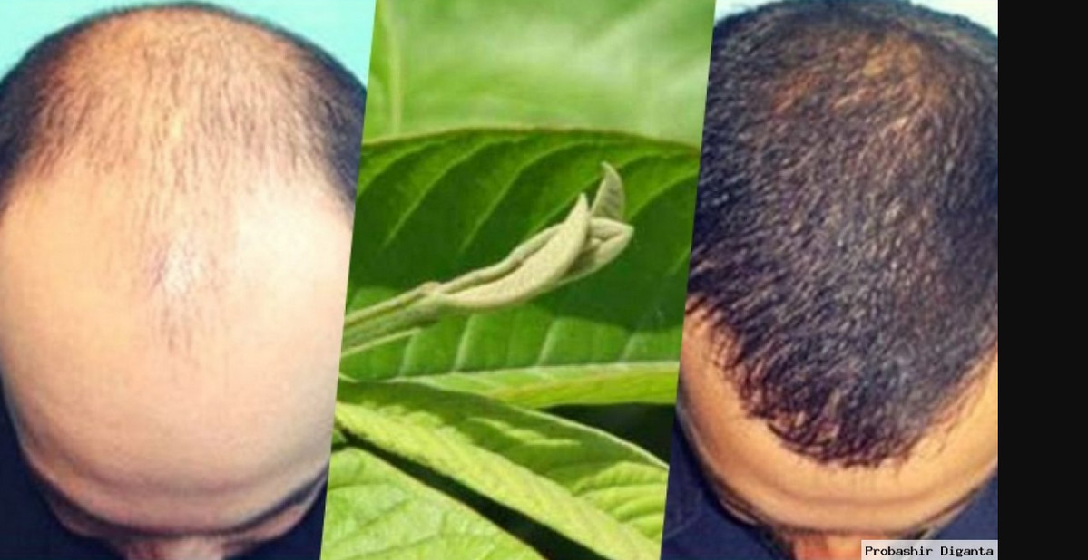 পেয়ারা পাতার ব্যবহারে মিলবে চুল পড়া সমাধান