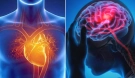 কিভাবে বুঝবেন ২১ দিনের মধ্যে আপনার স্ট্রোক হবে