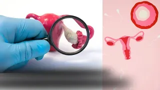 ৩ টি লক্ষণ থাকলে কখনো সন্তান হবে না