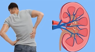 ৫ লক্ষণ দেখলেই বুঝবেন কিডনি ক্যানসার