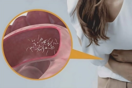 আপনার শরীরে কি কৃমি বাসা বেঁধেছে? চিনে নিন ৫টি প্রধান লক্ষণ