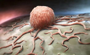 ৫ লক্ষণ দেখলেই বুঝবেন ক্যানসারে ভুগছেন