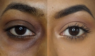 চোখের নিচের কালো দাগ দূর করুন ৩ মিনিটে